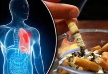 دراسة : التدخين سبب رئيسي في الإصابة بأمراض القلب وزيادة معدل الوفيات
